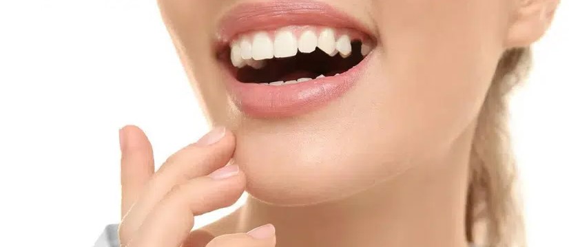 Periodontal Disease and Bone Loss